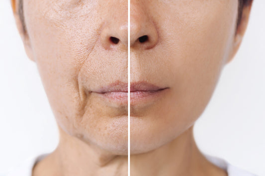 The Science Behind Skin Aging: Causes and Solutions